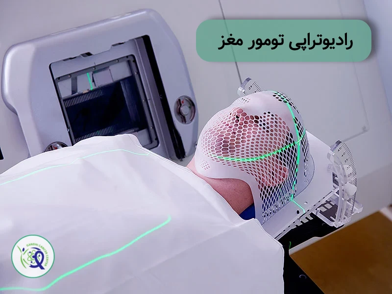 رادیوتراپی تومور مغزی