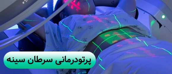 پرتودرمانی سرطان سینه