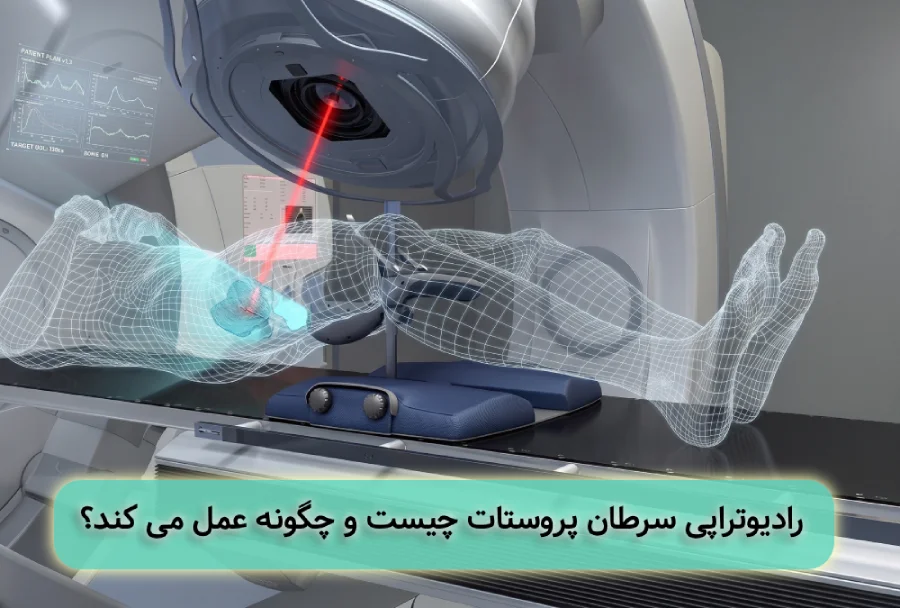 رادیوتراپی سرطان پروستات