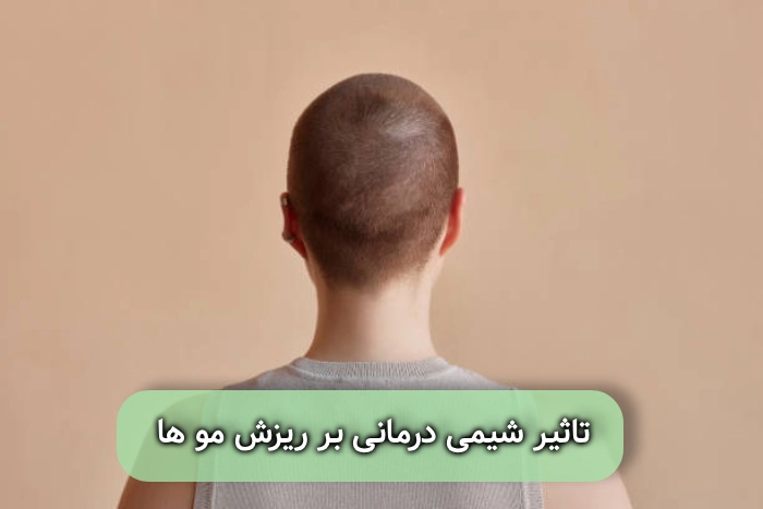 تاثیر شیمی درمانی بر ریزش مو